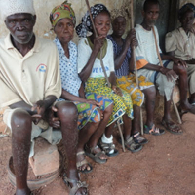 In Suakoko: Lepers abandoned